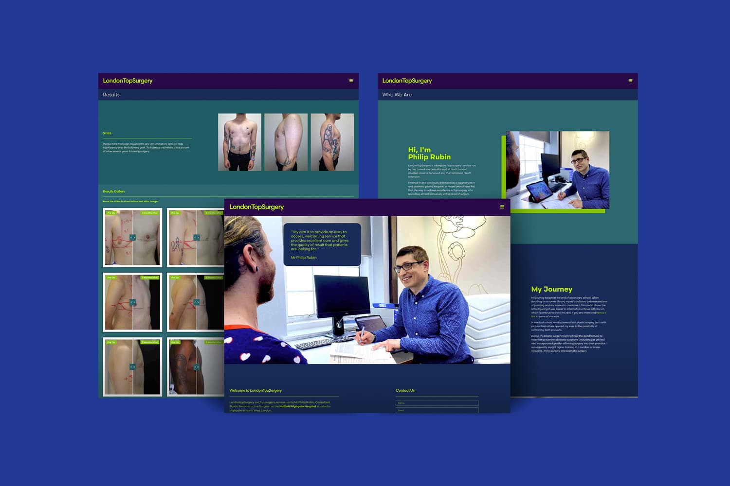 London Top Surgery